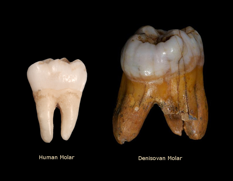 DenisovanHumanTooth